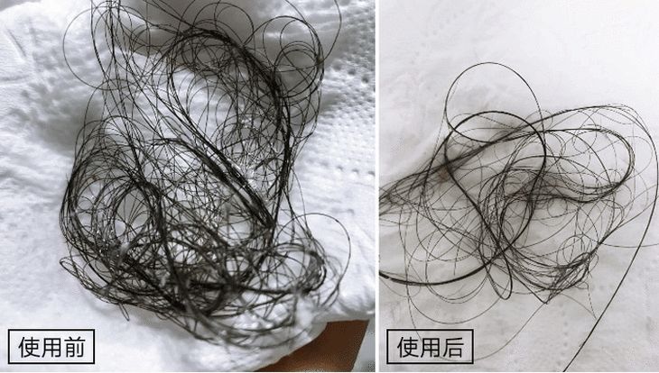 听说90后已经开始脱发了,听说第一批90后已经开始脱发了