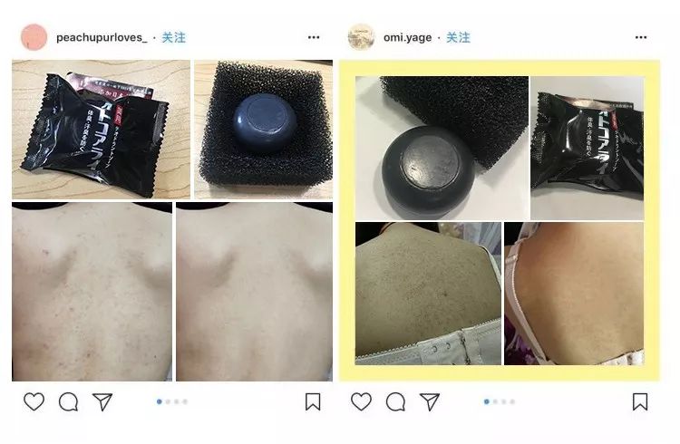 教你1分钟清除99%的脸上螨虫,10秒祛螨虫的药膏