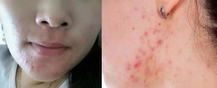 你晒被子10次，比不上我用它喷一回！除螨99%，裸睡都可以