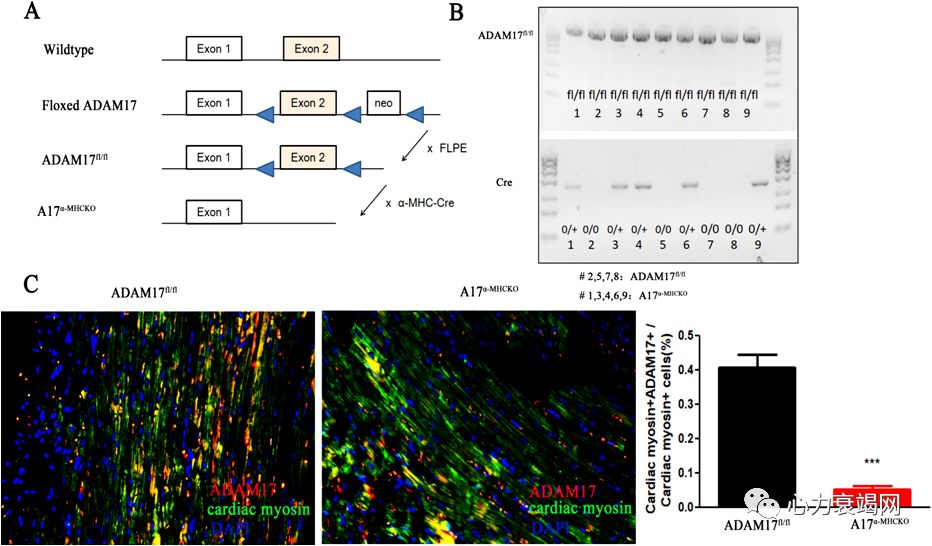 「2019CIHFC」张运教授:ADAM17—糖尿病性心肌病干预的新靶点
