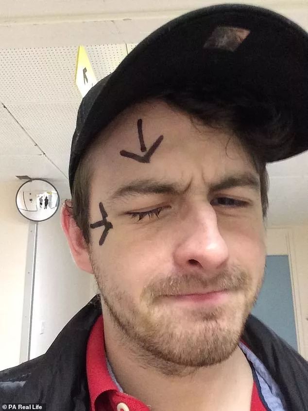 戴隐形眼镜眼睛长虫有什么症状,戴隐形眼镜把眼角膜磨坏了