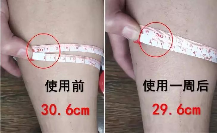 治疗肩颈痛的神器,好的缓解肩颈疼痛产品