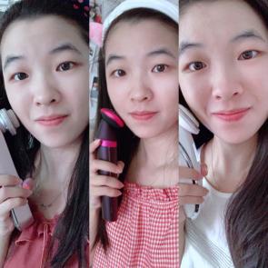 雅萌美容仪器max二代排行榜第一名,雅萌哪款美容仪性价比高