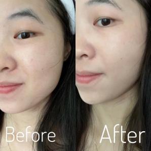 雅萌美容仪器max二代排行榜第一名,雅萌哪款美容仪性价比高