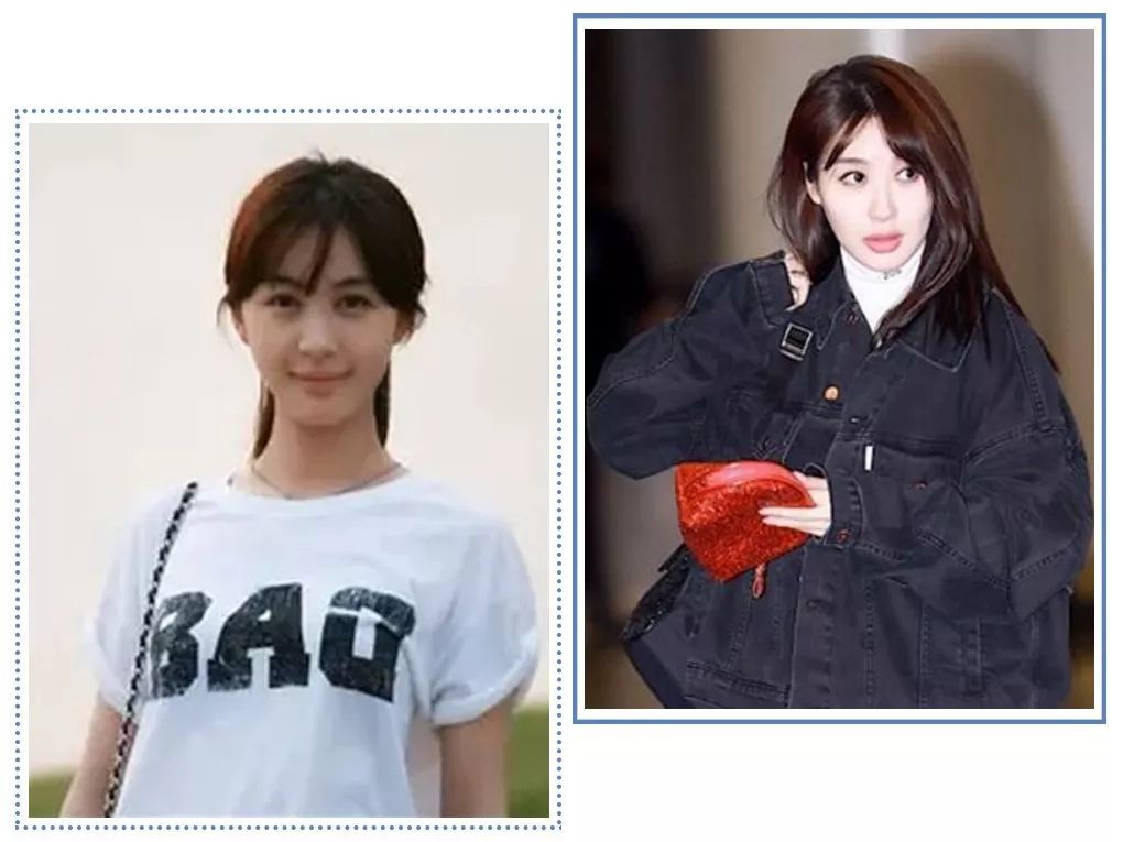 泫雅丰唇后颜值下跌?!但大家都爱这样的“香肠嘴”啊