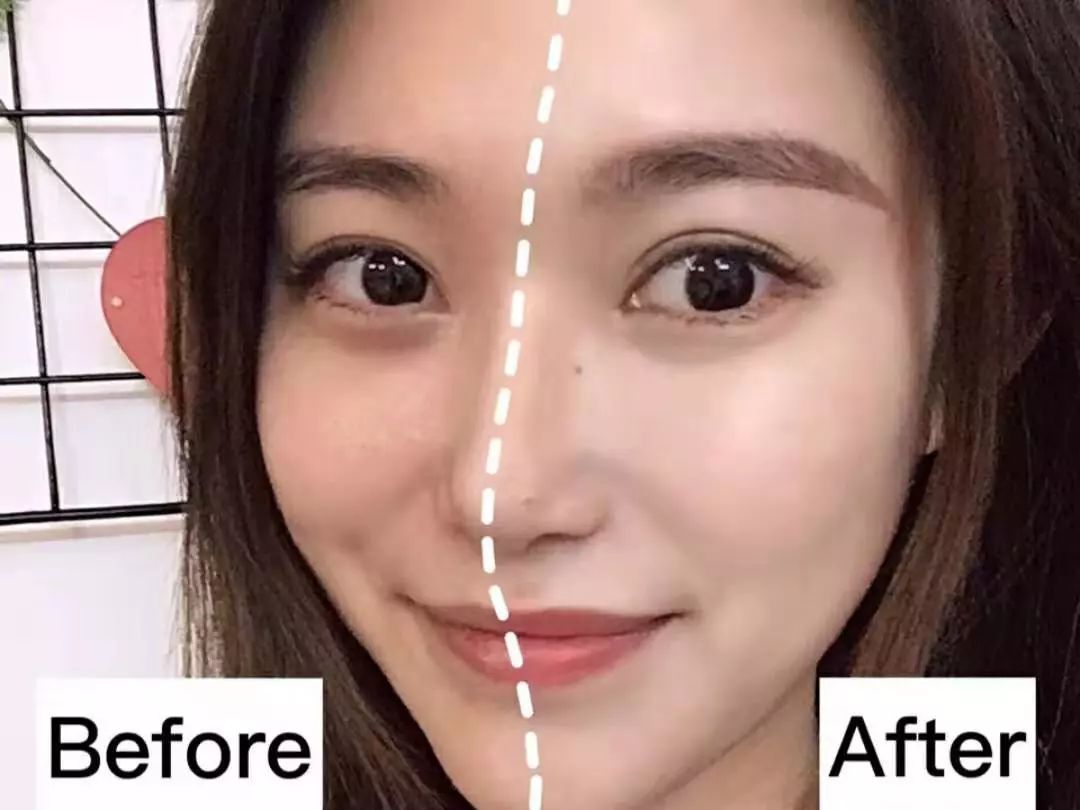 黑科技一秒祛斑,黑科技美白真的有效吗