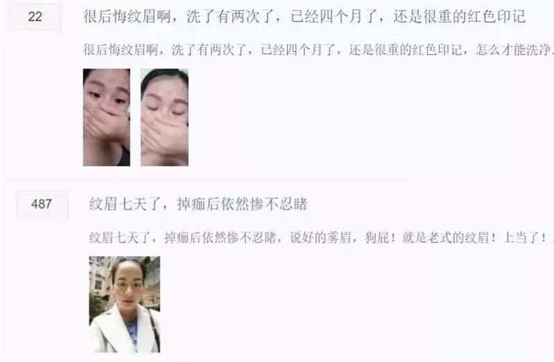 纹眉一周后眉毛还没完全掉痂,纹眉之后我的眉毛不长了