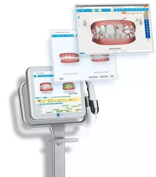 暑期矫牙季来啦你准备好了吗,暑期矫牙特惠