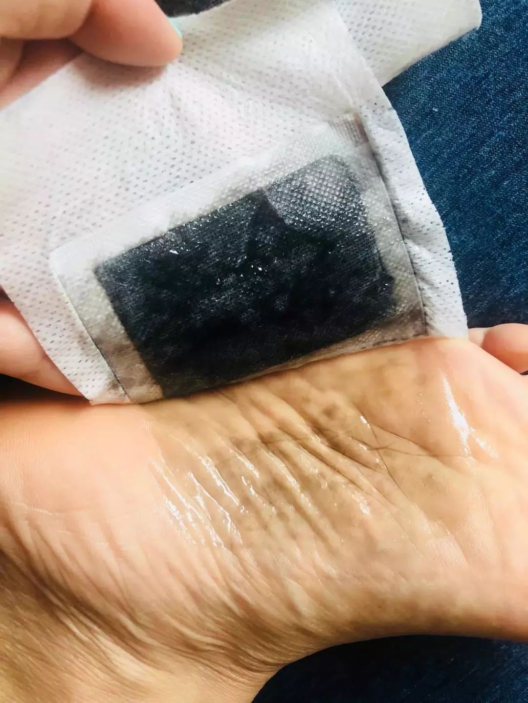 祛湿足贴的效果好吗,韩版养生祛湿足贴