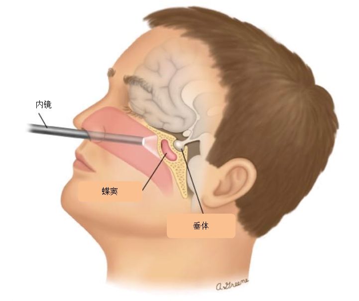 什么?!打嗝止不住是脑子有问题?