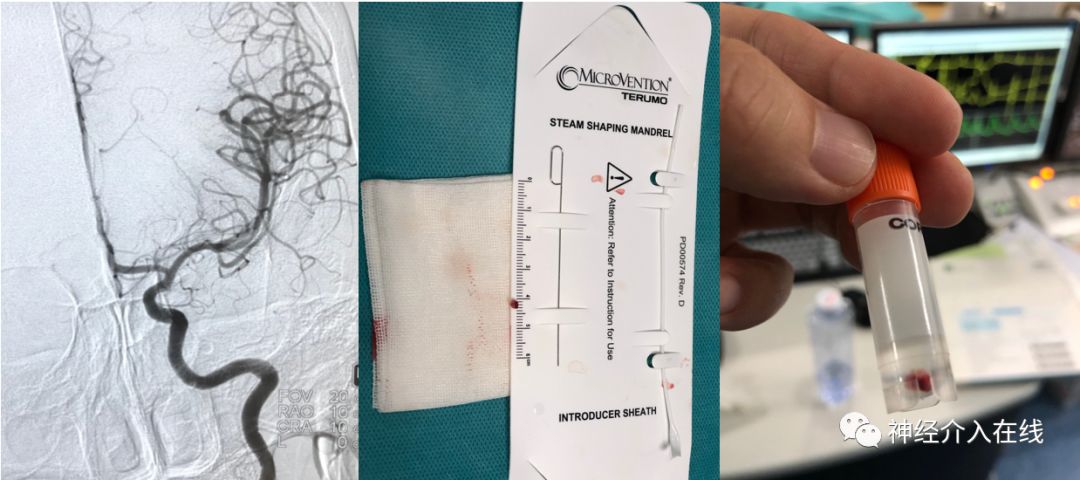 旭日东升第三式,旭日东升第三部