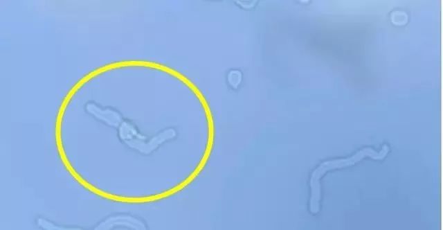 眼睛会发光的小虫,眼睛里有小虫子爬的感觉是咋回事