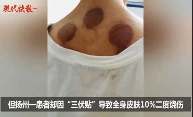 三伏贴真的有那么好的效果吗,三伏贴的优缺点