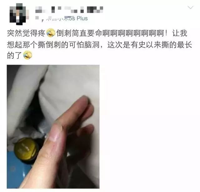 一个没注意,手指倒刺变截指!这个动作千万别再做了!