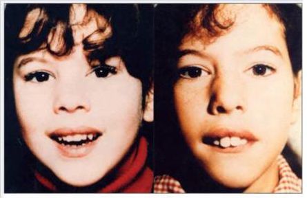 腺样体肥大手术家长反馈,家长腺样体肥大