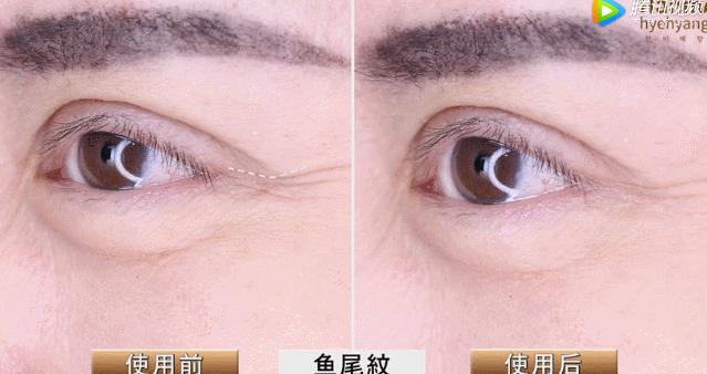 睡前一分钟做好这件事就能抗皱纹,最近比较火的淡化皱纹方法