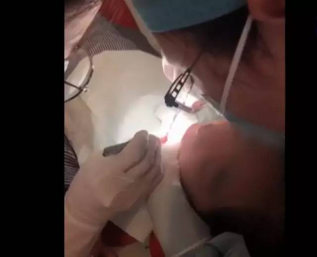 补牙舌头底下破了个洞,补牙把舌头弄破了需要怎么处理