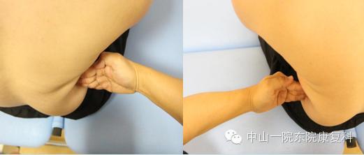 康复治疗技术人体解剖学,12条筋膜链解析及治疗手法