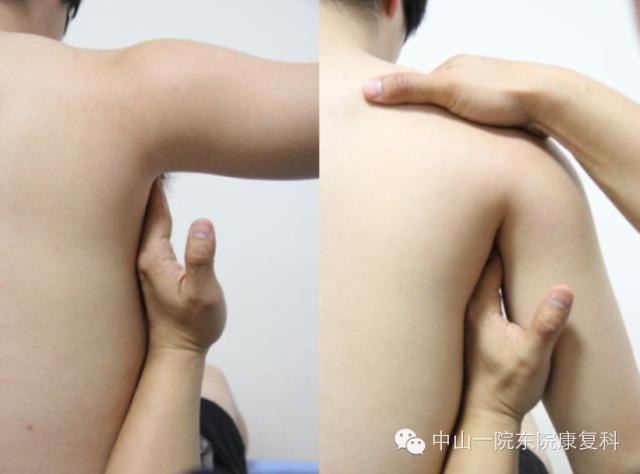 筋膜的康复训练方法,12条筋膜链解析及治疗手法