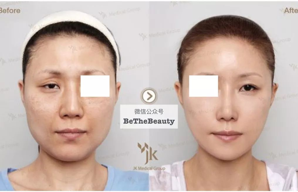 标准精致的脸属于什么脸型,什么样的脸型算是帅气的脸型