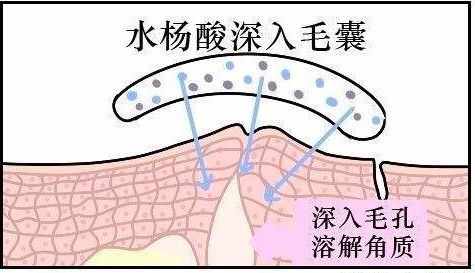 鍗佸勾铚曞彉缁堟垚鐢风,鍗佸勾铚曞彉tfboys
