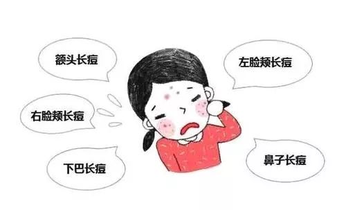 为什么脸上的痘痘那么难消,你脸上的痘痘是螨虫痘吗