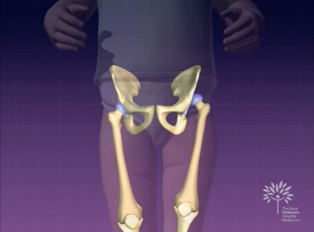 如何安全抱新生儿,宝宝裹襁褓睡会不会影响发育