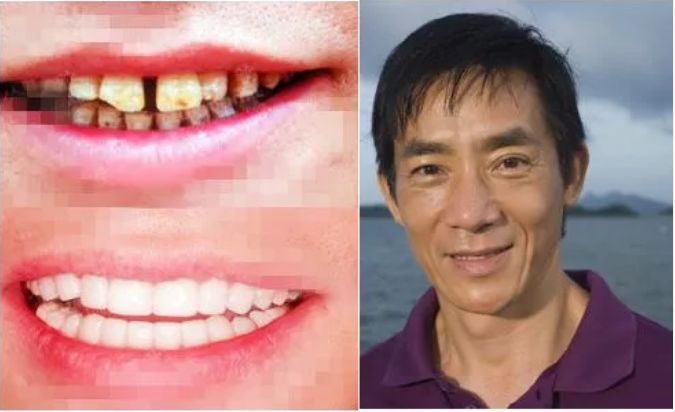 福州市民凭身份证免费牙齿矫正,身份证520开头免票