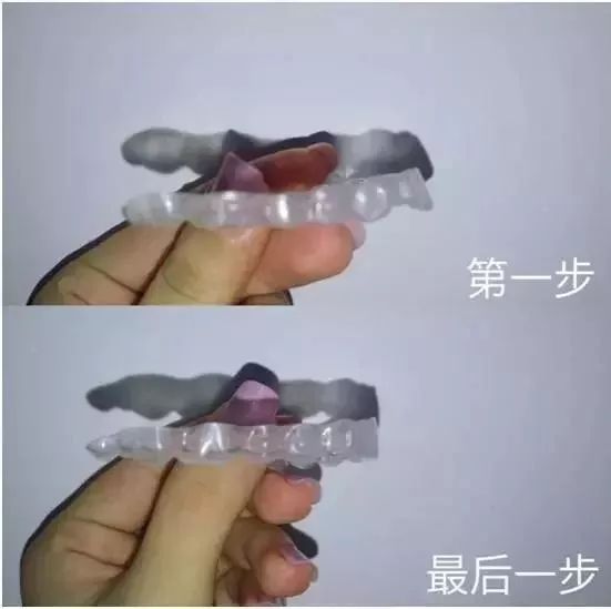 福州市民凭身份证免费牙齿矫正,身份证520开头免票