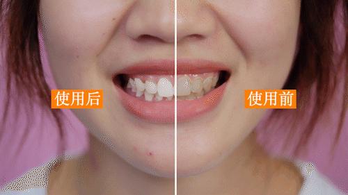 美白黄牙烟渍最好的牙膏,比洗牙还干净的美白牙膏适合牙黄