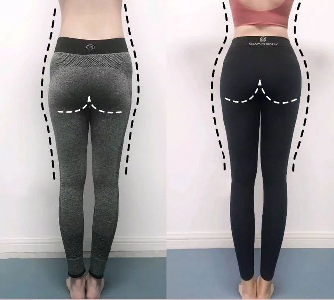 腿细翘臀神器,腿变得又细又直神器