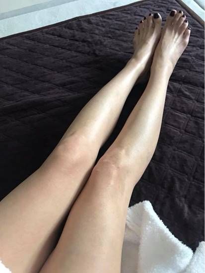 跑完步脚底板很痛但没有起泡,跑完步脚底板一踩就疼怎么回事