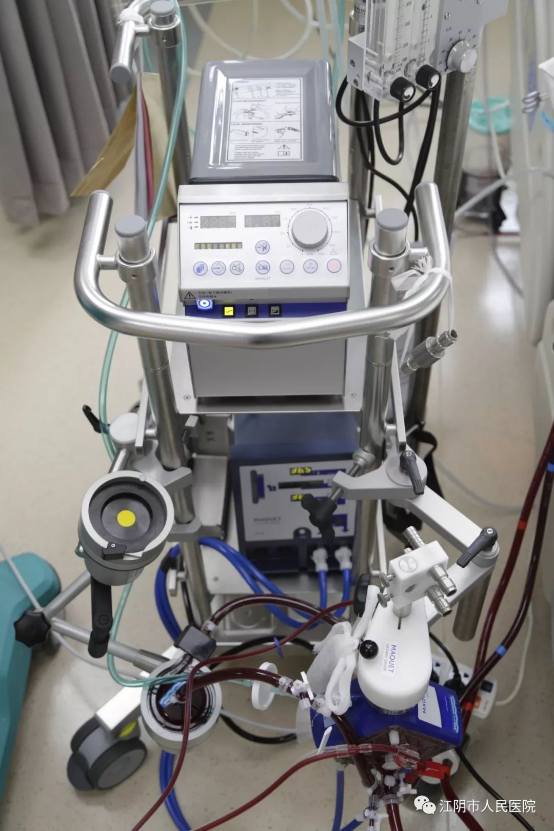 20岁小伙头痛欲裂一个月,小伙头痛ct居然查出肿瘤