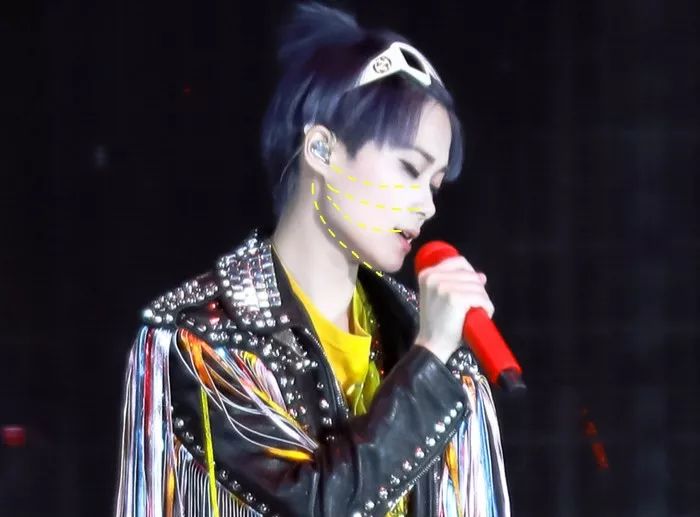 不削骨改变脸型,不削骨变脸型