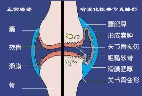 这12个坑人的养生建议,千万别信的十个养生建议