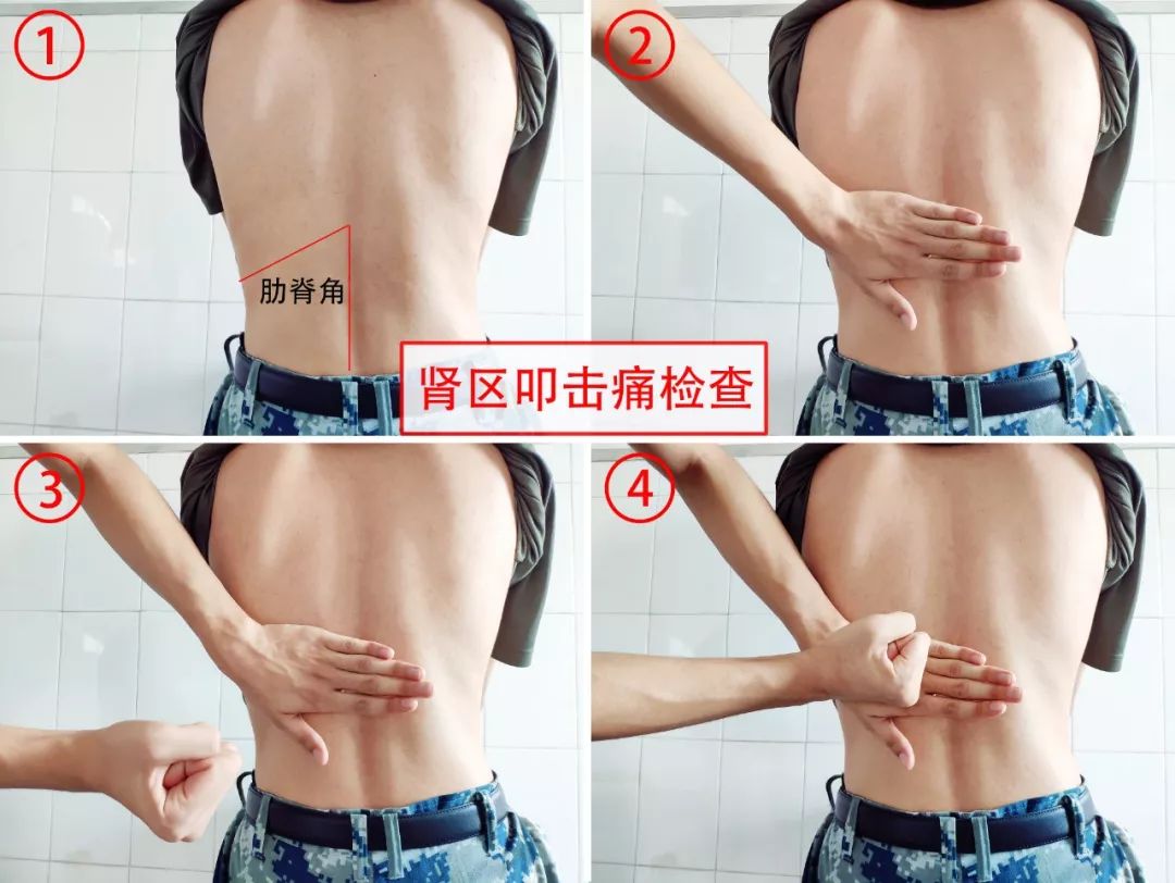 尿路感染要多喝水多排尿吗,尿路感染多喝水多排尿能自愈