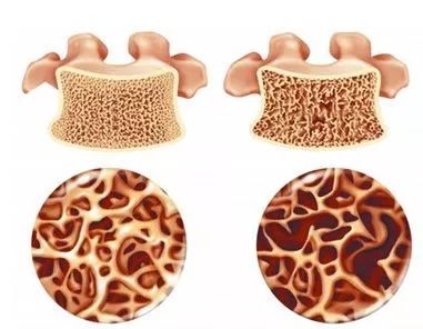 30岁以后吃什么钙片对骨关节好,氨糖软骨素钙片对骨关节有影响吗