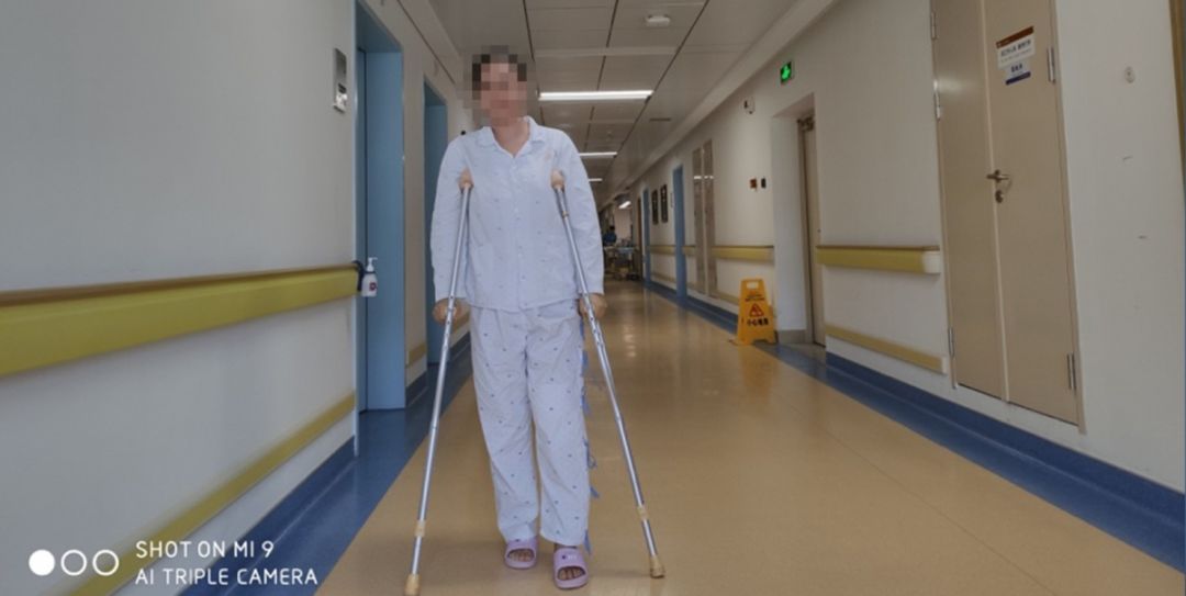 摔了一跤半月板二度撕裂,摔一跤膝盖半月板裂开了