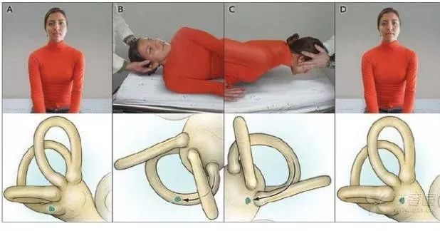 耳石症复位疗法视频,耳石症复位后的十大注意事项