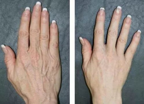 神奇绵羊油,润肤用的绵羊油