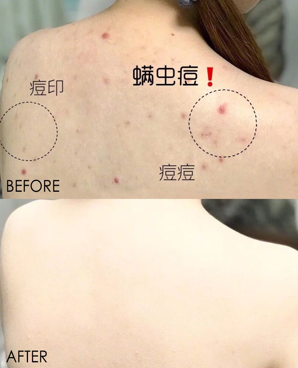 床上放个它，让螨虫绝望，让螨虫自杀，比太阳暴晒强1万倍