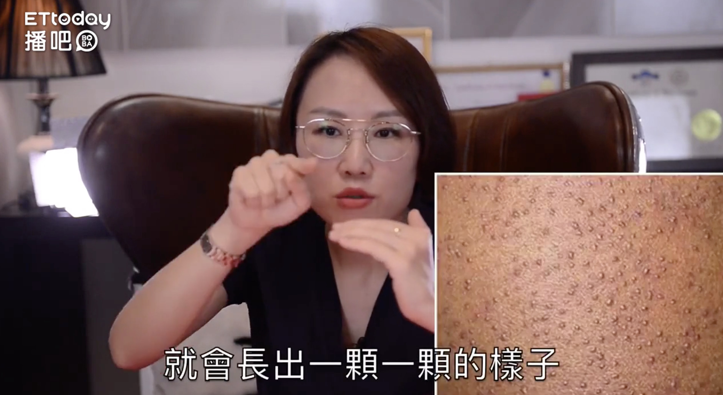 毛囊不长头发怎么恢复,毛囊角化黑点怎么治疗