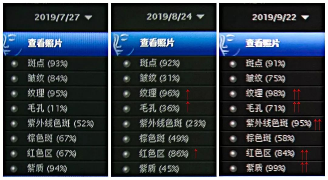 肌诊室·特别版|真人体验，医美素颜光vs明星微精华，改善皮肤哪家强？