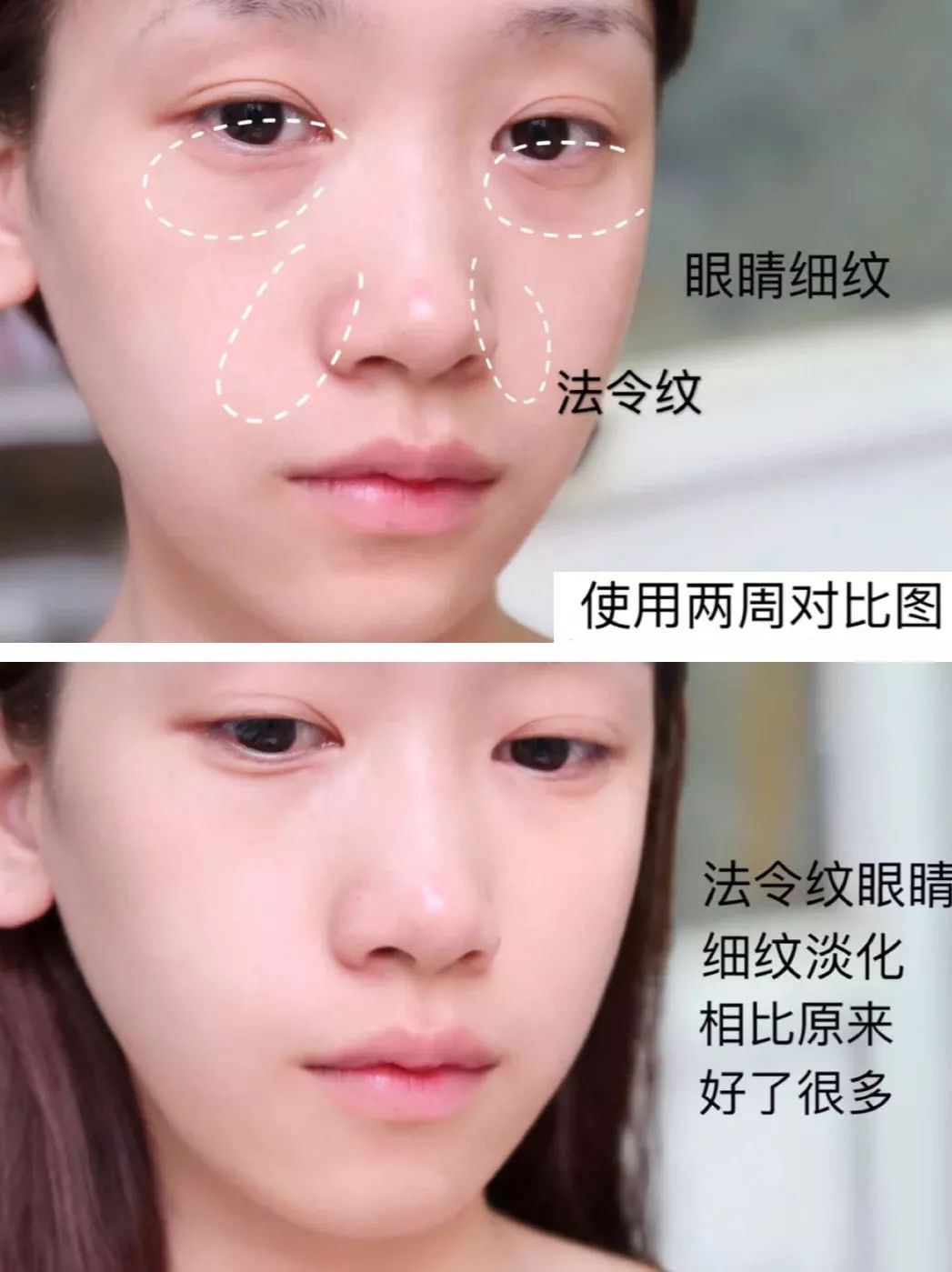 法令纹眼纹一个都逃不掉,法令纹和眼纹怎么才能有效改善