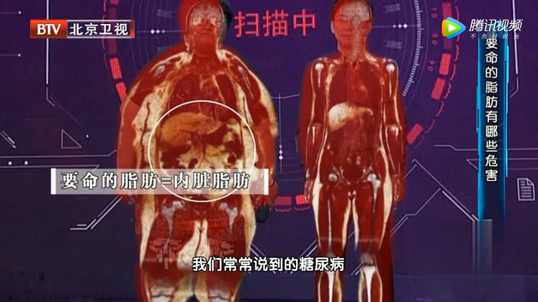 不饿也想吃点东西,不饿也总是想吃并且吃到难受