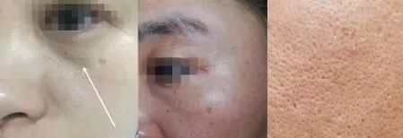 澳皙可涂抹面膜,澳皙可海藻面膜适合什么肤质