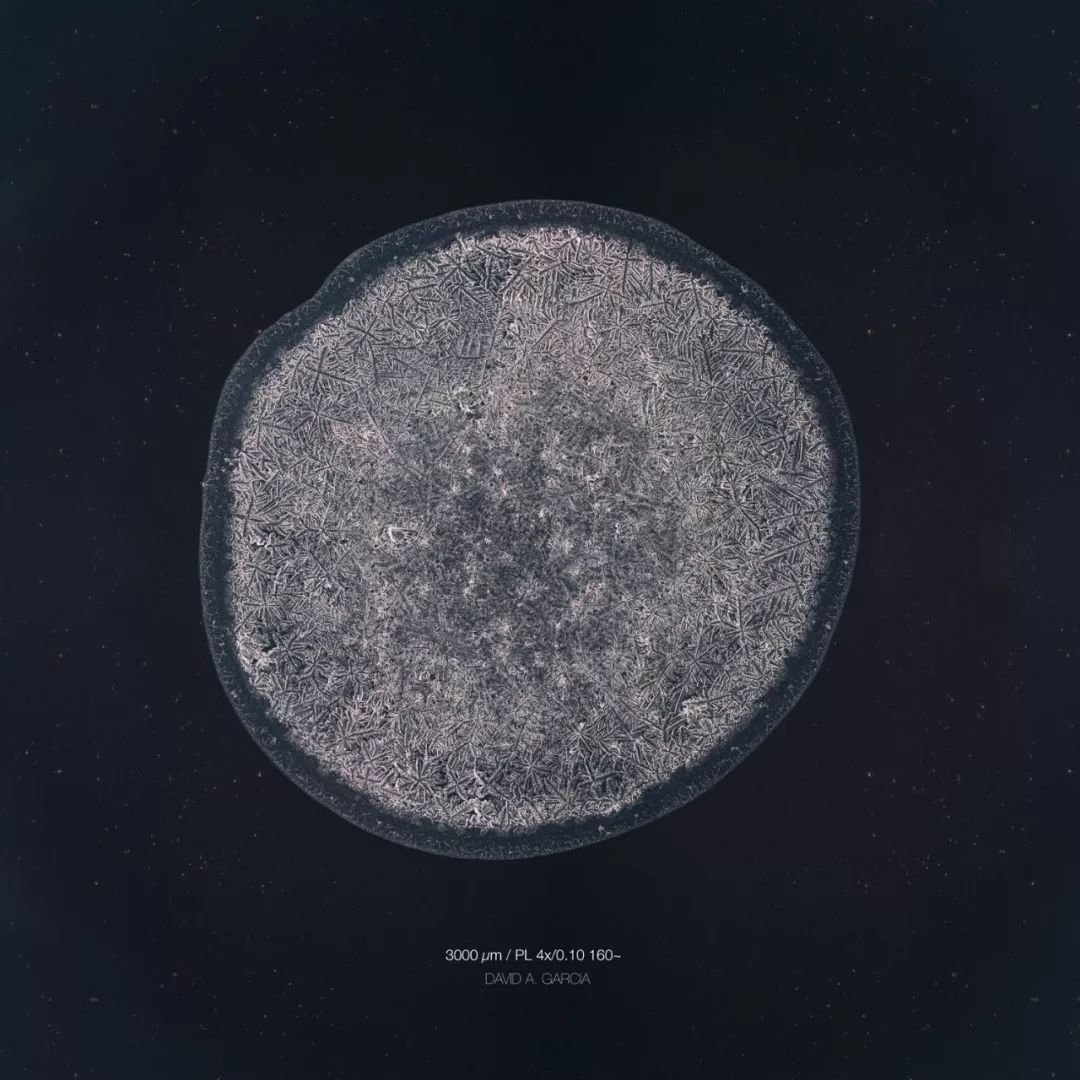 显微镜下的各种眼泪,显微镜下的眼泪原版