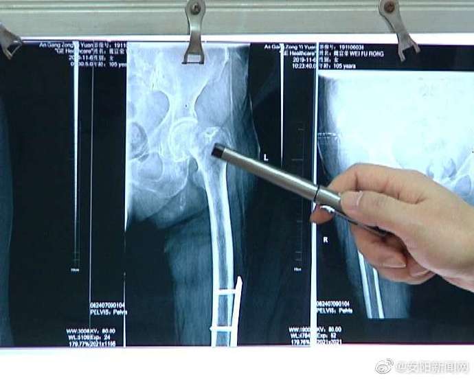 安钢总医院,安钢总医院病例