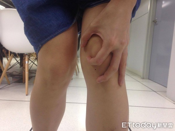 小伙骨折半年自愈,男孩因车祸险遭截肢老中医