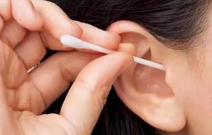 清理耳垢有用吗,耳垢多长时间掏一次最好